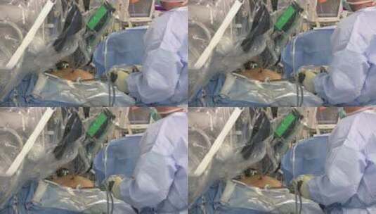 机械在外科手术中的应用高清在线视频素材下载