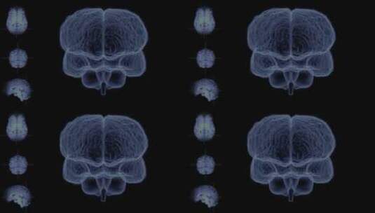 大脑扫描三维建模医疗科技生物监测高清在线视频素材下载