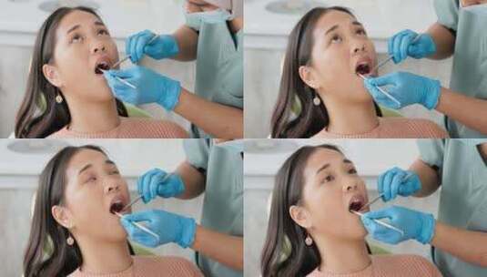 亚洲妇女、牙医和患者，在牙科护理中使用清高清在线视频素材下载
