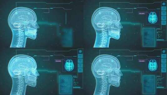 动画、信息图、头骨、医疗高清在线视频素材下载