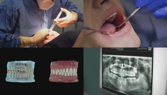 牙医系列素材高清在线视频素材下载