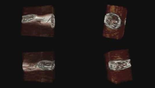 腕部核磁 手腕MRI影像 三维切片 10高清在线视频素材下载