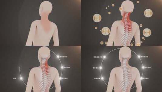 脊椎颈椎骨骼模板高清AE视频素材下载