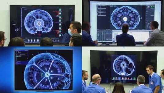 医学神经科学医院实验室会议谈论病人的治疗高清在线视频素材下载