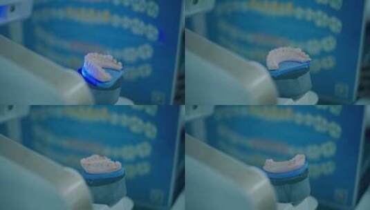 牙齿扫描高清在线视频素材下载