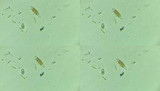 显微镜下的微观世界微生物 硅藻5高清在线视频素材下载