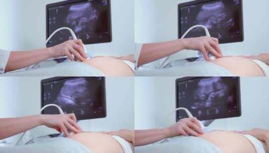 医院内医生的特写镜头对孕妇进行超声波高清在线视频素材下载