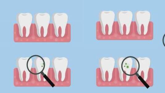 牙医检查牙齿中的细菌不良口腔卫生动画高清在线视频素材下载