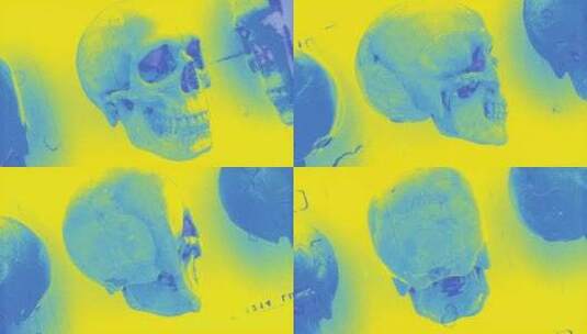 病历头骨08高清在线视频素材下载