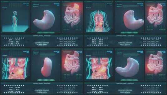 医学胃分析HUD高清在线视频素材下载