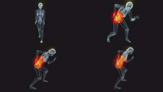 4K背痛女性的解剖学概念高清在线视频素材下载