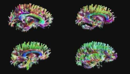 五彩大脑高清在线视频素材下载