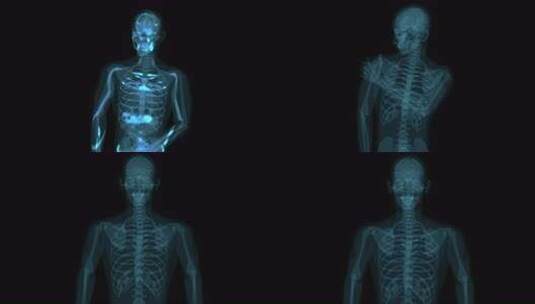 肩痛的4K抽象X线解剖学概念高清在线视频素材下载