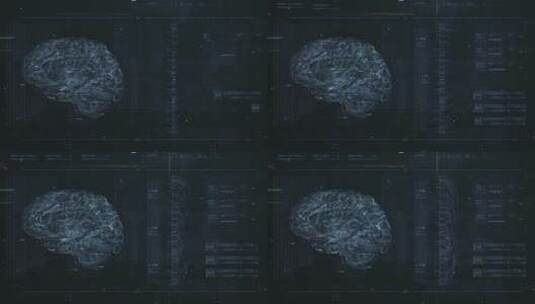 医疗大脑扫描科技屏幕操作系统交互界面UI高清在线视频素材下载