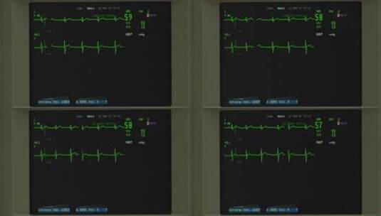 屏幕上出现正常的心电图高清在线视频素材下载