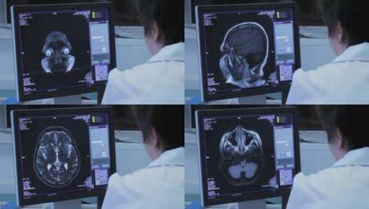 脑科医生高清在线视频素材下载
