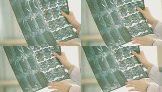 病人拍摄的CT片子高清在线视频素材下载