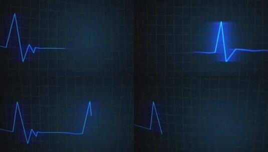 监测器、心跳、心电图、脉搏高清在线视频素材下载