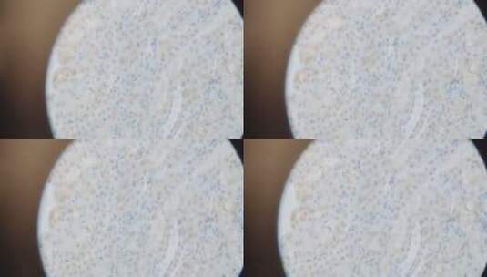 显微镜下的病毒结构高清在线视频素材下载
