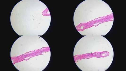寄生虫肝吸虫切片高清在线视频素材下载