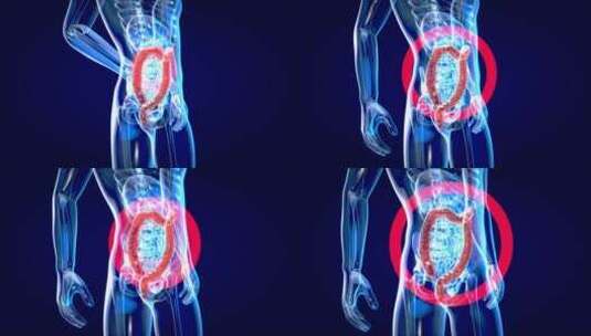 高科技医疗x光下的人体肠道组织解剖学手术高清在线视频素材下载