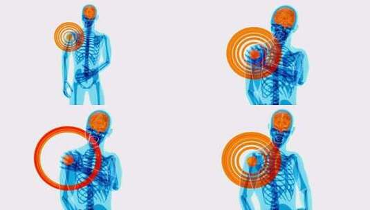 4K肩痛的解剖学概念高清在线视频素材下载