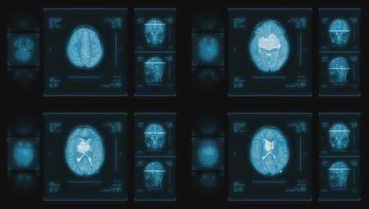 医学 大脑 脑科学 三维 脑ct1 模型高清在线视频素材下载