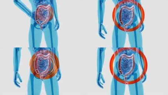 高科技医疗x光下的人体肠道组织解剖学手术高清在线视频素材下载