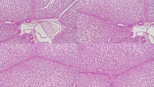 明场100倍放大显微镜下拍摄的人体肝脏高清在线视频素材下载