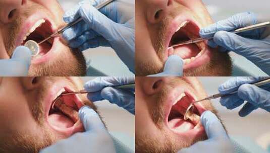 牙医检查男人的牙齿高清在线视频素材下载