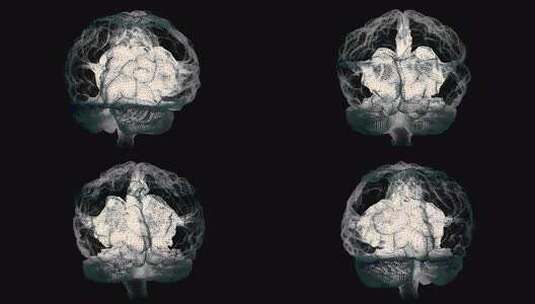 人类白色大脑在黑色，科学解剖背景。人脑就高清在线视频素材下载