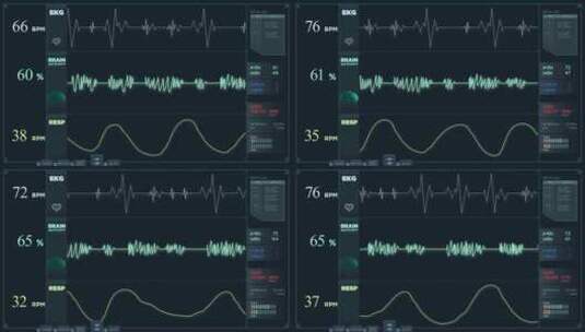 正常模式下的心电图显示读数高清在线视频素材下载
