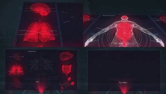医学解剖HUD标志高科技技术动画高清AE视频素材下载