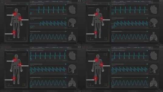 医疗检测监控科幻屏幕HUD操作系统智能界面高清在线视频素材下载