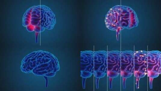 医学 大脑 脑科学 三维 脑ct1 模型高清在线视频素材下载