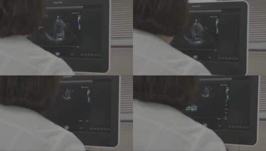 医生用超声波观察胎儿高清在线视频素材下载