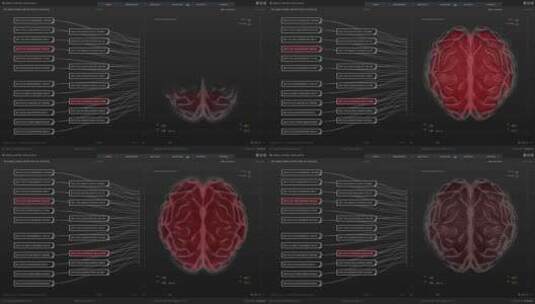 大脑扫描CT科幻屏幕HUD操作系统智能界面高清在线视频素材下载
