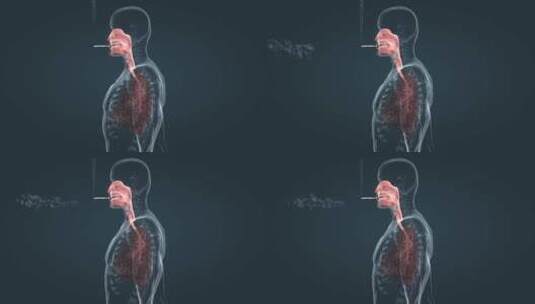 吸烟烟圈肺部病变得肺癌过程三维动画高清在线视频素材下载
