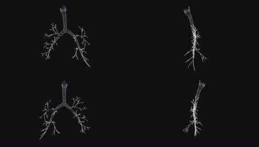 喉、气管、支气管全息图高清在线视频素材下载