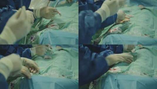 外科医生带手套检查病人高清在线视频素材下载