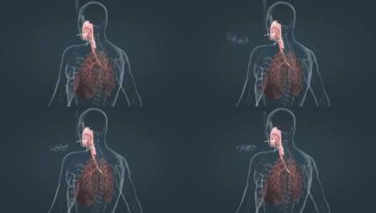 肺癌 肺病变 肺部 人体重要器官三维动画高清在线视频素材下载