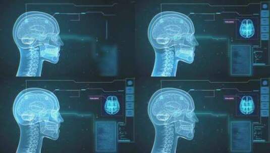 动画、信息图、头骨、医疗高清在线视频素材下载