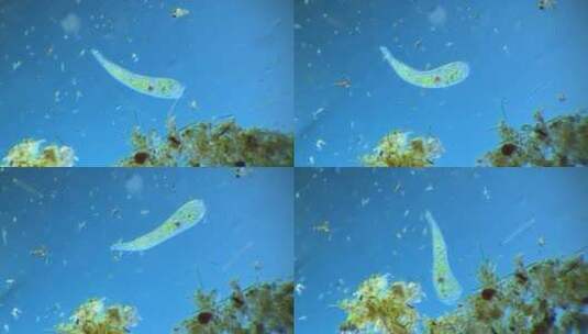显微镜下的微观世界微生物 喇叭虫2高清在线视频素材下载