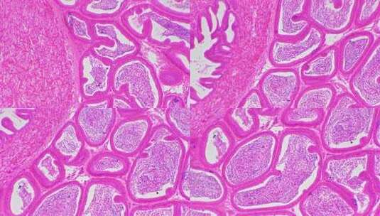 横切面显微镜下显示睾丸并放大100倍高清在线视频素材下载