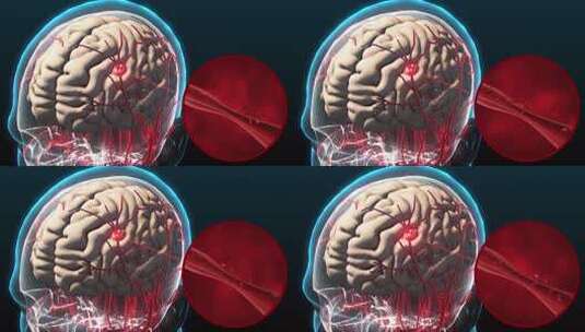 人体医学素材高清在线视频素材下载