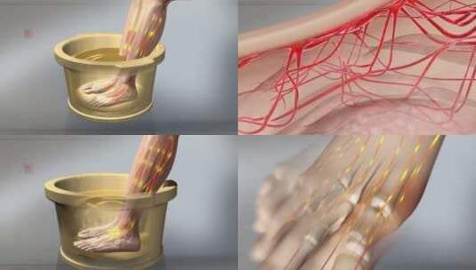 痛风 中医 泡脚 热疗 痛风石 强身健体高清在线视频素材下载