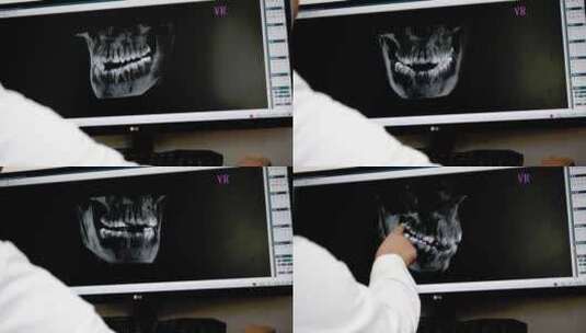 精品 · 口腔科医生正在给病人看牙片高清在线视频素材下载