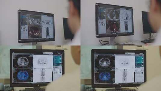 医生查看医疗影像的工作场景高清在线视频素材下载