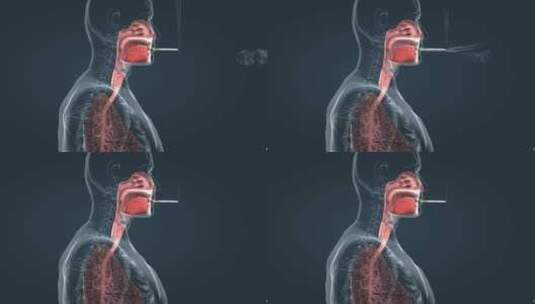 医学人体动画 器官 肺脏 呼吸道疾病动画高清在线视频素材下载