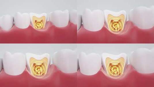 牙齿的解剖图神经炎症高清在线视频素材下载